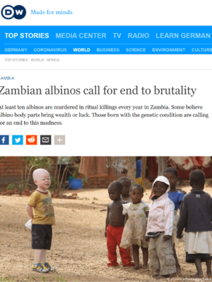 Campaign to end albino killings
The Albino Foundation of Zambia (AFZ) has been campaigning for the equal treatment of people living with albinism and for an end to the misconception that their bodies could be used to gain wealth. John Chiti, Executive Director of AFZ, told DW that Zambian albinos are worried about their safety.
"We have people who hunt down persons with albinism for their body parts, which they believe can cure certain diseases and make money," Chiti said. He also said persons with albinism are living in fear and are not really enjoying their full human rights. "All the time they have to worry about who‘s behind them and many of them have lost their lives." Zambian albinos call for end to brutality