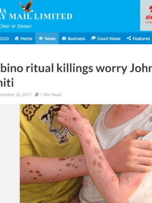 Albino ritual killings worry John Chiti